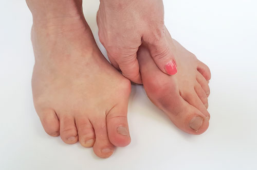 Painful Foot Conditions