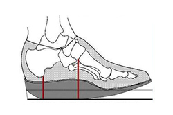 Orthotic Ankle Joint Rocker