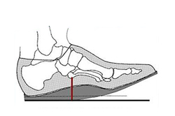 Orthotic Healing Rocker