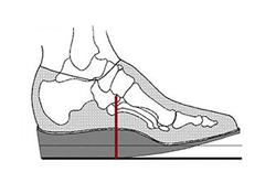 Orthotic Lisfranc Rocker