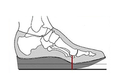 Orthotic MPJ Rocker